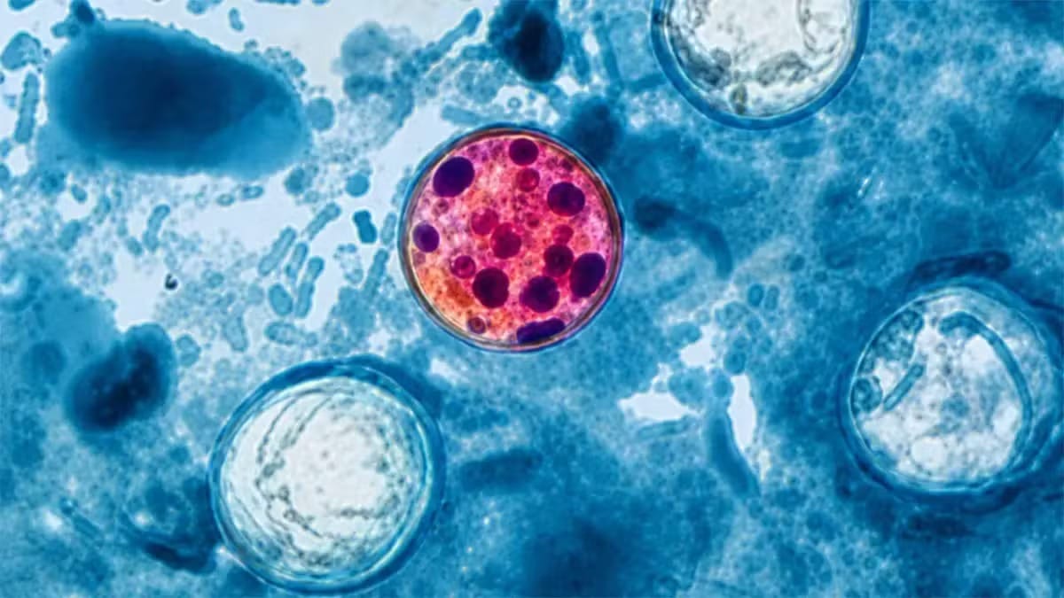 Imagem de microscópio mostrando um oocisto do parasita Cyclospora corado em rosa e roxo sobre um fundo azul com outras estruturas celulares