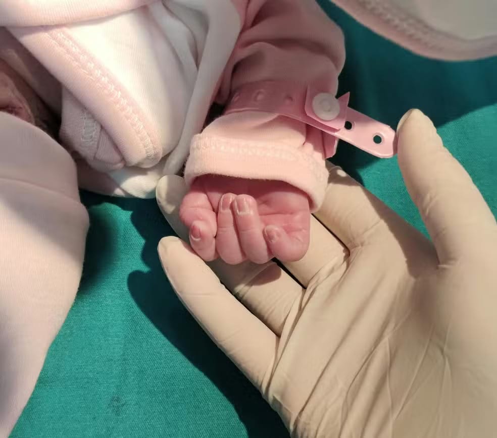 Mão de um recém-nascido, com pulseira de identificação hospitalar rosa, segura o dedo de um profissional de saúde que usa luva cirúrgica, sobre um campo cirúrgico verde